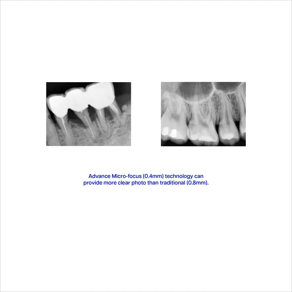 KM-841 Portable X-Ray Machine