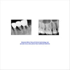 KM-841 Portable X-Ray Machine