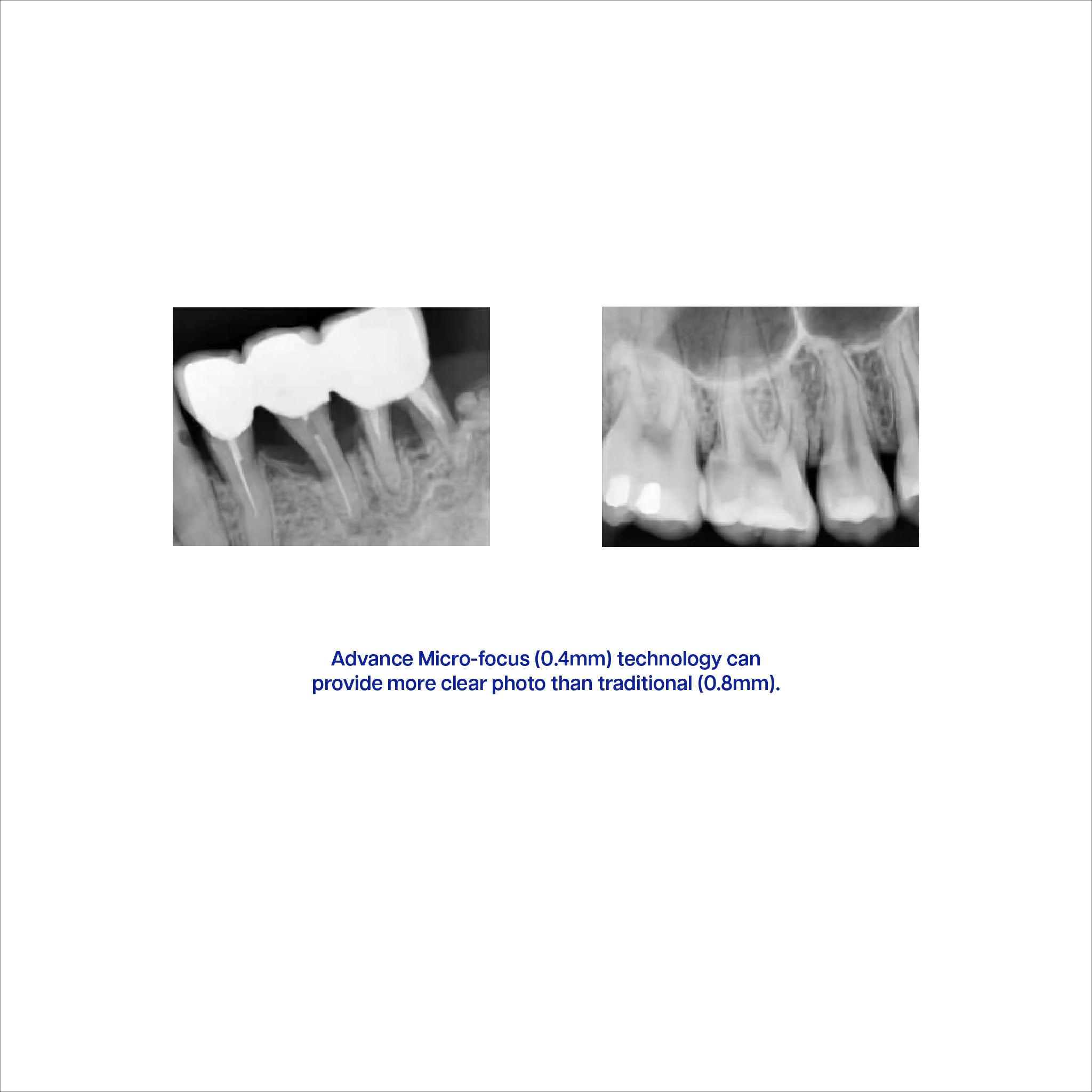 BR-841 Portable X-Ray Machine